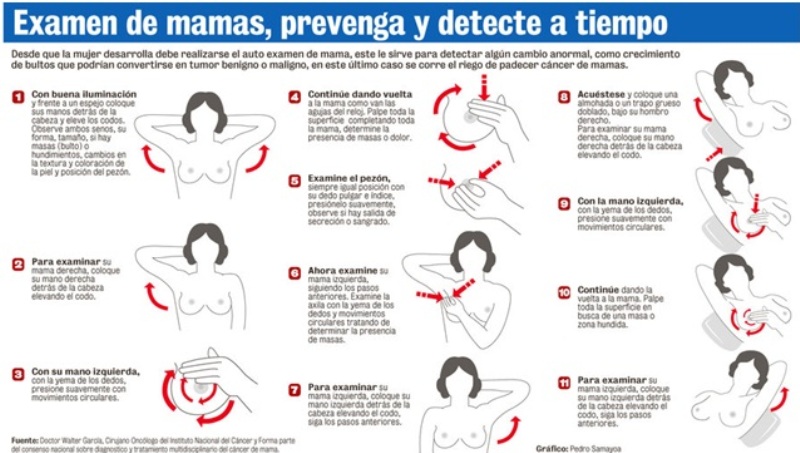 Cáncer de mama