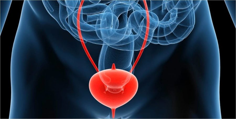 Cáncer de próstata